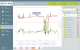 Schocksensor und Datenlogger ASPION G-Log 2 als Einzelgerät